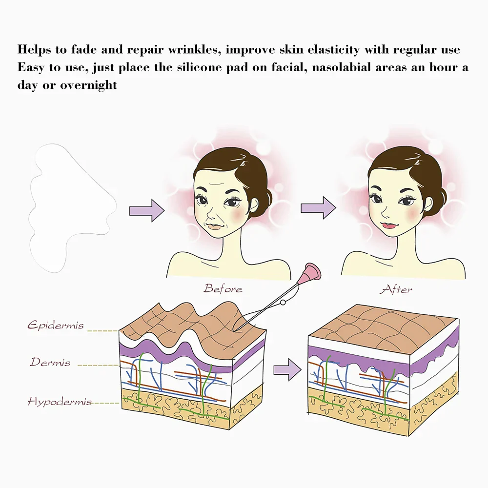Facial Wrinkle Remover Pad Reusable Medical Grade Silicone Nasolabial Folds Anti-aging Mask Prevent Wrinkle Skin Lifting Patches - Image 5