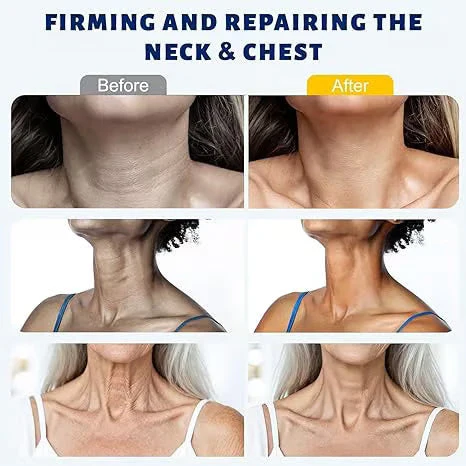 🪄Rolimey® Neck Firming Roller Cream | Collagen & Hyaluronic Acid Anti-Ageing Cream for Wrinkles, Sagging Skin & Double Chin - Image 5